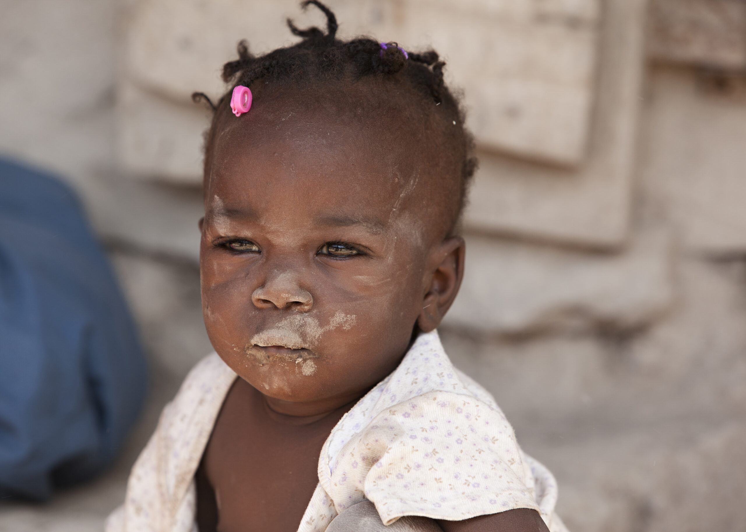 Kinder, konfrontiert mit dem Hunger: Eine beispiellose Nahrungsmittelkrise in Haiti