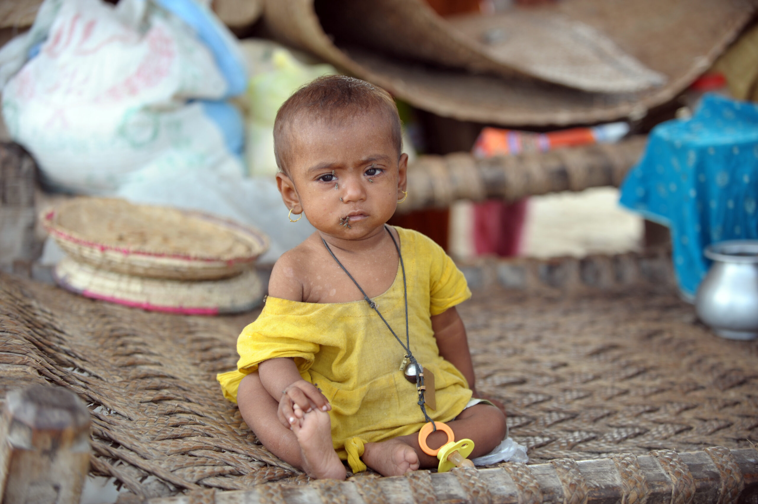 Rekordraten an mangelernährten Kindern in Pakistan